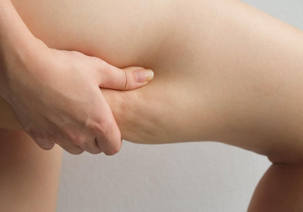 Cellulite effektiv behandeln mit Rotlichttherapie
